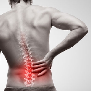 Back Pain: Causes And Symptoms