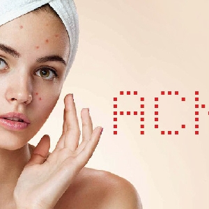What Is Acne?