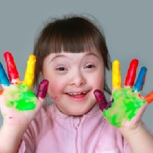 What Is A Down Syndrome?