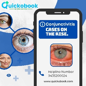 Conjunctivitis Cases On The Rise: What Is This Infection?