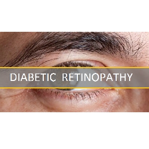 Diabetic Retinopathy : What You Should Know