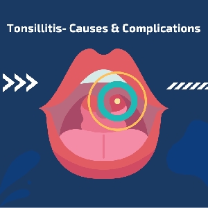 Tonsillitis- Causes & Complications