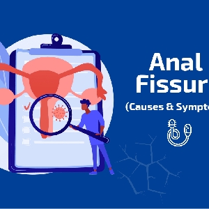 Anal Fissure Causes & Symptoms