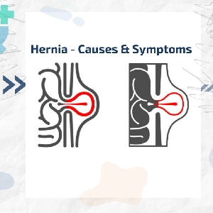 Hernia - All You Need To Know