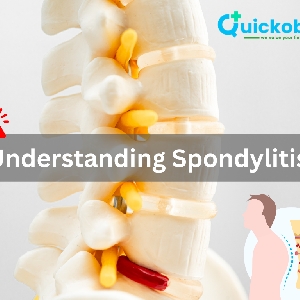 Understanding Spondylitis : Symptoms, Causes, And Management