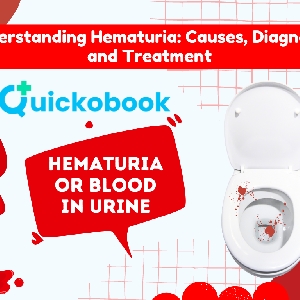 Understanding Hematuria : Treatment, Causes & Diagnostics